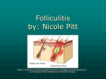 Folliculitis - Shorecrest Preparatory School