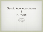 Gastric Adenocarcinoma & H. Pylori