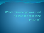Which microscope was used to take the following pictures?