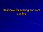 Rational ofscaling root planing