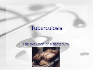 Tuberculosis