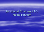 Junctional Rhythms / A-V Nodal Rhythm