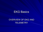 EKG Basics - Phlebotomy Career Training