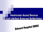 Ventricular Assist Devices Zoll LifeVest External