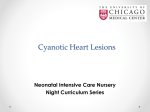 Cyanotic Heart Lesions