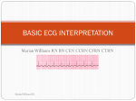 ECG Interpretation - American Heart Classes