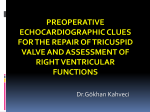 Preoperative echocardiographic clues for the repair of