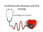 Cardiovascular Diseases and ECG tracings