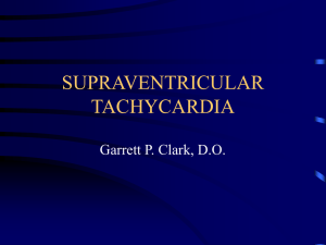 SUPRAVENTRICULAR TACHYCARDIA