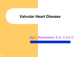 Valvular Heart Disease - South Jersey Heart Group