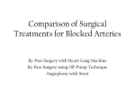 Comparison of Treatment Techniques for Blocked Arteries