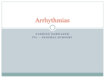 Arrhythmias 3