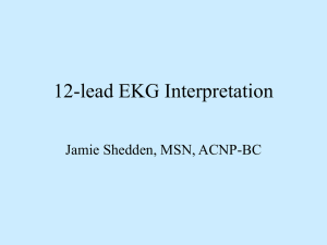 12-Lead EKG Interpretation - Mississippi Nurses Association