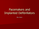 Pacemakers and Implanted Defibrillators