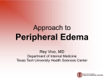 Approach to Peripheral Edema - Texas Tech University Health