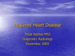 Acquired-Heart
