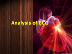 24 Analysis of ECG