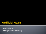Artificial Heart