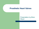 Heart Valves - SeniorScienceKGS