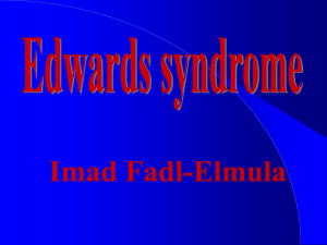 Edwards syndrome