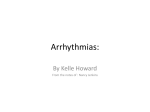 Arrhythmias: Hyperfunction