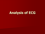 Lecture 23. Analysis of ECG