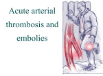 Acute arterial impassability