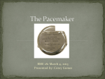 The Pacemaker