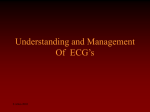 Understanding ecgs