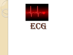 ECG Leads