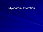 Myocardial infarction
