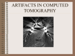 ARTIFACTS IN COMPUTED TOMOGRAPHY