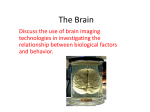 The Brain - AP Psychology
