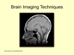 the MRI