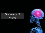 Lecture 2 Discovery of x-rays