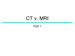 CT v. MRI