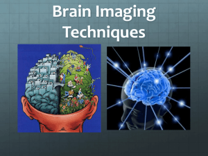 Computerized Tomography