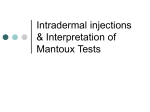 Intradermal injections & Interpretation of Mantoux Tests
