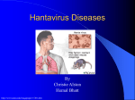hantavirus disease