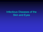 PowerPoint Presentation - Infectious Diseases of the Skin and Eyes