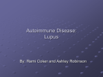 Autoimmune Disease: Lupus
