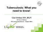 TB or Not TB??? - lookmatters.net