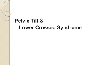 Pelvic Tilt & Lower Crossed Syndrome