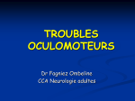 TROUBLES OCULOMOTEURS