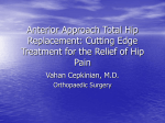 Hip Replacement: Cutting Edge Treatment for the Relief of