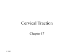 Cervical Traction - Therapeutic Modalities