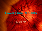 Lower Limb Replants
