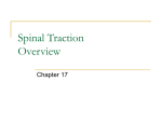 Spinal Traction - Therapeutic Modalities