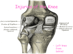 Injuries of the Knee