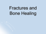 Fractures and Bone Healing PPT